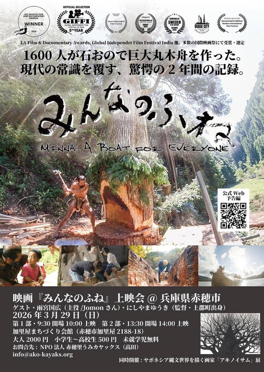 ��������˱ǲ�ؤߤ�ʤΤդ͡پ�ǲ� ���Ĥȼ�餬���������